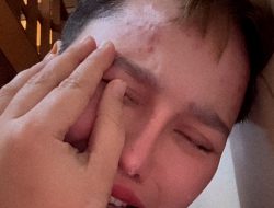 Terlindungi: Putri Asal Sulsel Jadi Korban Pelecehan di Loby Hotel Bali